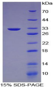 Figure 1. SDS-PAGE