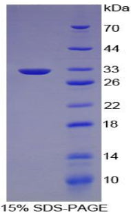 Figure 1. SDS-PAGE
