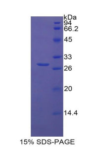 Figure 1. SDS-PAGE