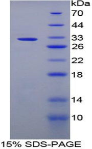 Figure 1. SDS-PAGE