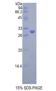 Figure 1. SDS-PAGE