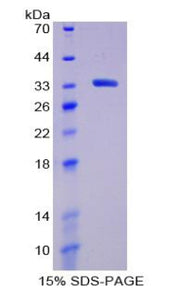 Figure 1. SDS-PAGE