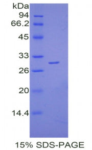 Figure 1. SDS-PAGE