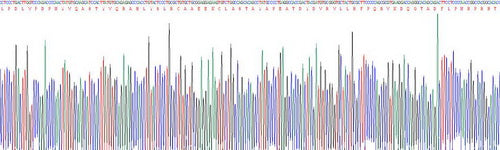 Recombinant Human Lysyl Oxidase Like Protein 1 (LOXL1)