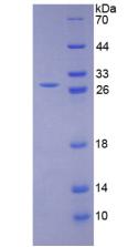 Figure 3. SDS-PAGE