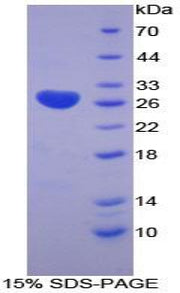 Figure 1. SDS-PAGE