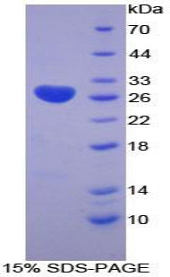Figure 1. SDS-PAGE