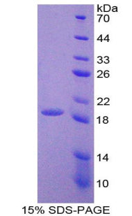 Figure 1. SDS-PAGE