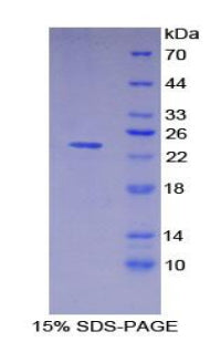 Figure 1. SDS-PAGE