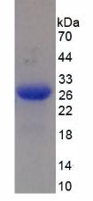 Figure 2. SDS-PAGE