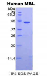 Figure 1. SDS-PAGE