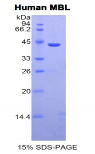 Figure 1. SDS-PAGE