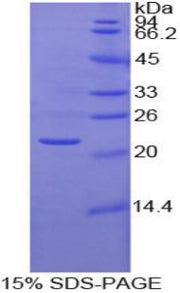 Figure 1. SDS-PAGE