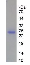 Figure 2. SDS-PAGE