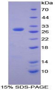 Figure 1. SDS-PAGE