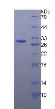 Figure 2. SDS-PAGE