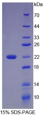 Figure 1. SDS-PAGE