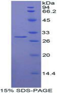 Figure 1. SDS-PAGE