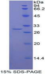 Figure 1. SDS-PAGE