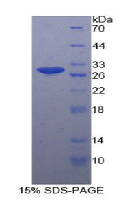 Figure 1. SDS-PAGE