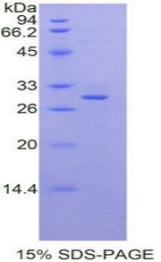 Figure 1. SDS-PAGE