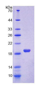 Figure 1. SDS-PAGE