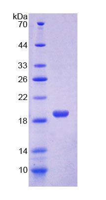 Figure 1. SDS-PAGE