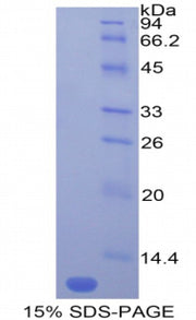 Figure 1. SDS-PAGE