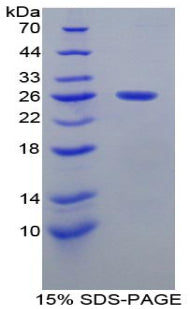 Figure 1. SDS-PAGE