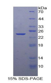 Figure 1. SDS-PAGE