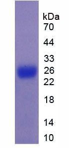Figure 2. SDS-PAGE