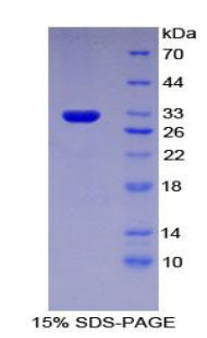 Figure 1. SDS-PAGE
