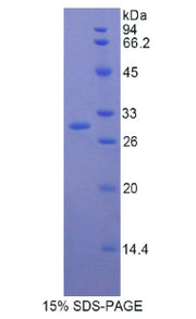 Figure 1. SDS-PAGE