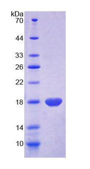 Figure 1. SDS-PAGE