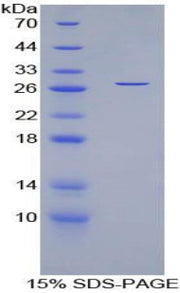 Figure 1. SDS-PAGE