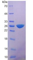 Figure 2. SDS-PAGE