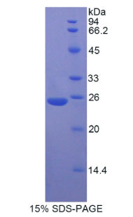 Figure 1. SDS-PAGE