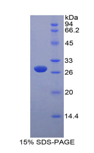 Figure 1. SDS-PAGE