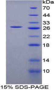 Figure 1. SDS-PAGE