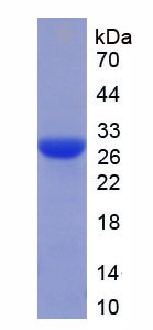 Figure 2. SDS-PAGE