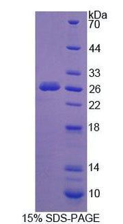 Figure 1. SDS-PAGE