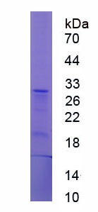 Figure 1. SDS-PAGE