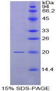 Figure 1. SDS-PAGE