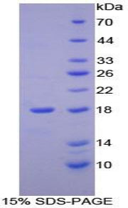 Figure 1. SDS-PAGE