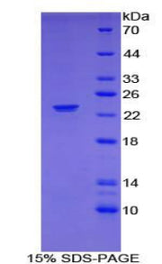Figure 1. SDS-PAGE