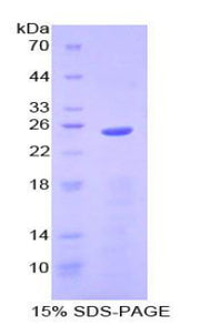 Figure 1. SDS-PAGE