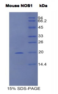 Figure 1. SDS-PAGE
