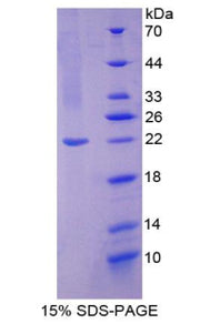 Figure 1. SDS-PAGE
