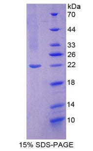 Figure 1. SDS-PAGE