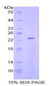 Figure 1. SDS-PAGE